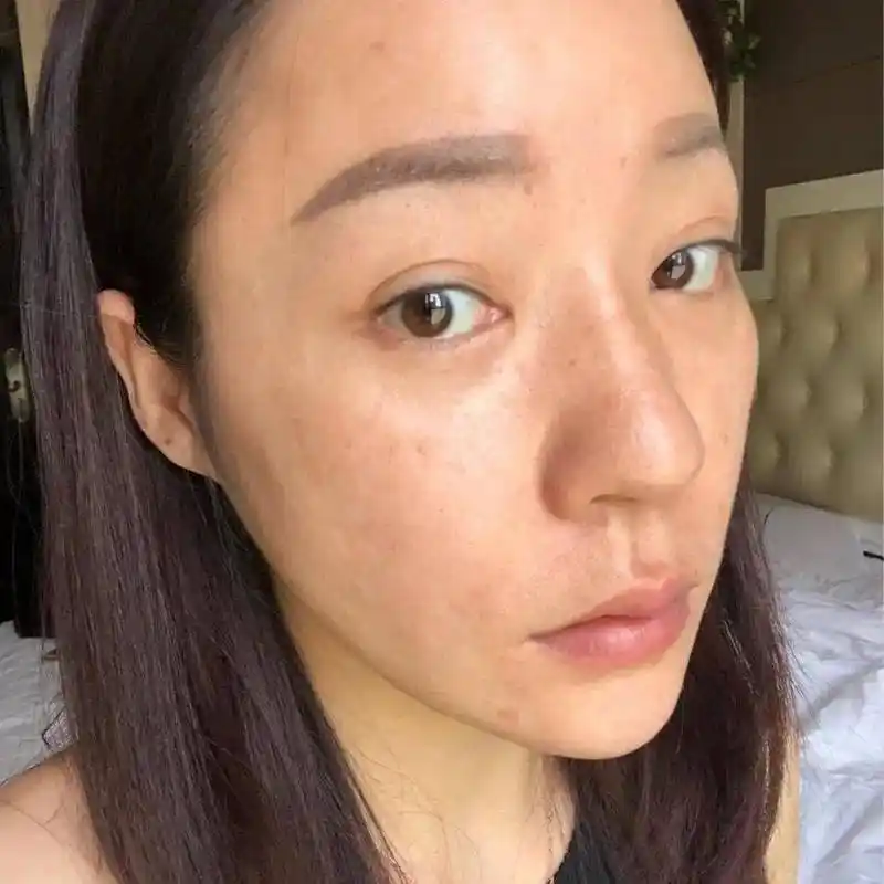 知道为什么你的皮肤暗黄吗?看完你就懂了!