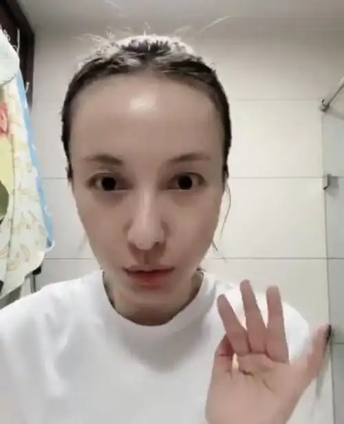 37岁吴昕素颜出镜自信爆棚眉毛像缺了一块脱发严重露出大脑门