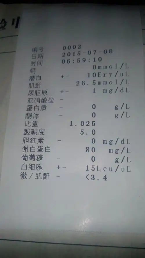 3 分钟前冷血书生06 分类:电脑/网络来自:手机知道 男性泌尿科医疗