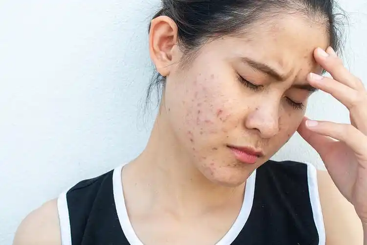 肌肤 油性皮肤 痘图片—正版肌肤 油性皮肤 痘图片_高清肌肤 油性皮肤