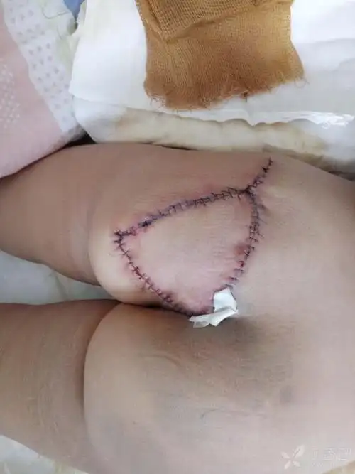 可能涉及到敏感图片,点击后可查看