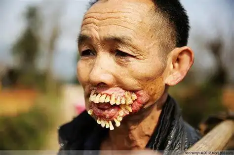 没牙齿的老人图片大全老年人没有牙齿的图片2022已更新今日动态