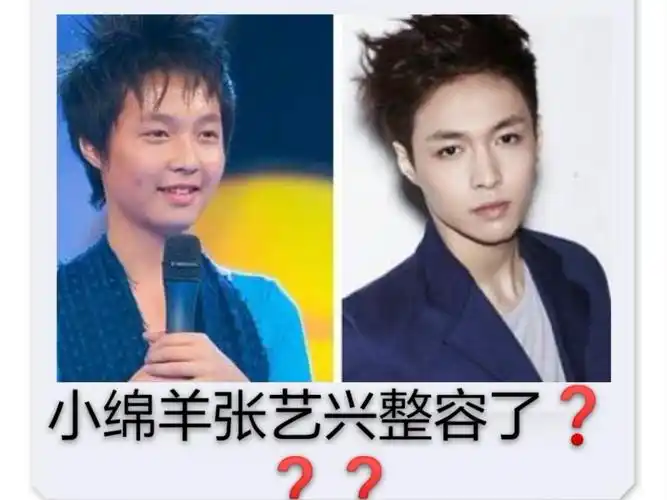 张艺兴跟之前的模样不太一样,那么他是整容了吗
