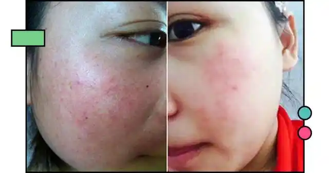 可都别忘了 过度水合的可怕!