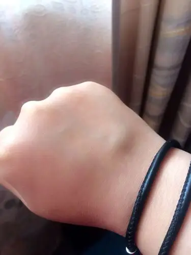 所以这几天手背皮疼 也没当回事 3,4天过去了,今天感觉手背疼 右手一