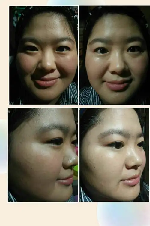 莱芙蔻"抗衰老生命密码护肤品祛斑祛痘去褶皱"产品使用前后惊人对比图