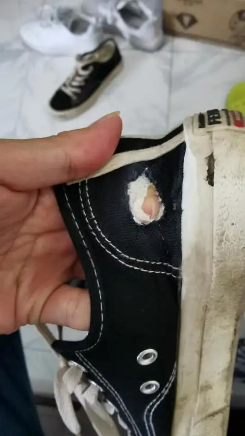 请问帆布鞋破了一个洞有没有便宜的修补办法
