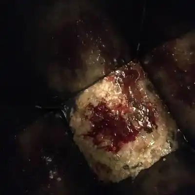 怀孕快三个月了,一般都是隔天吐一次,晚上吐,今天晚上吐出好多血,怎麼