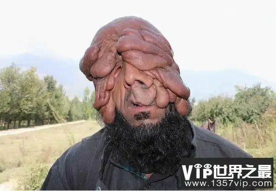 世界上最恶心的人,又丑又恶心的男人和女人(图片)(3)