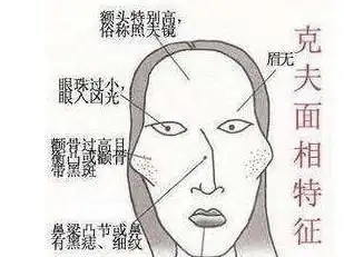 克夫相的女人面相一脸的克夫相的特征