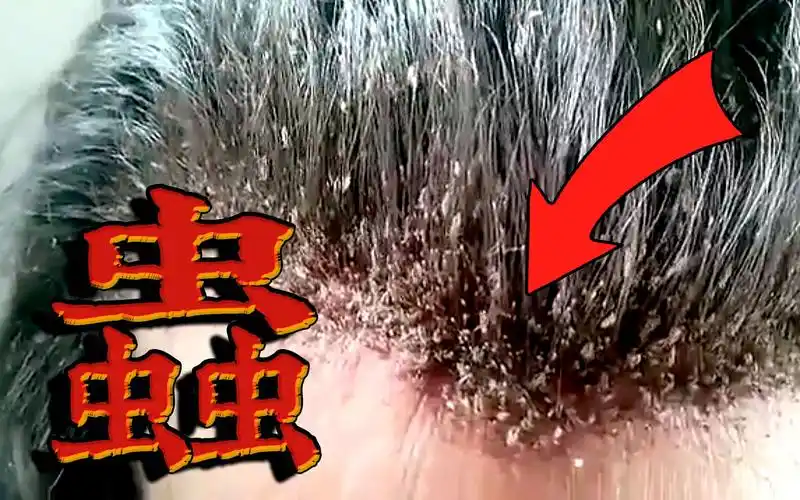 六个密集恐惧者禁止观看的虫子影片 | 鸡皮疙瘩 !