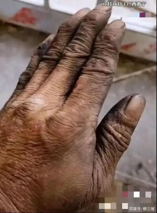 隔着屏幕我都想轻轻抚摸与握住这只粗糙,爆皮,裂口,黝黑,关节变形的手