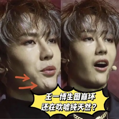 王一博这脸怎么了
