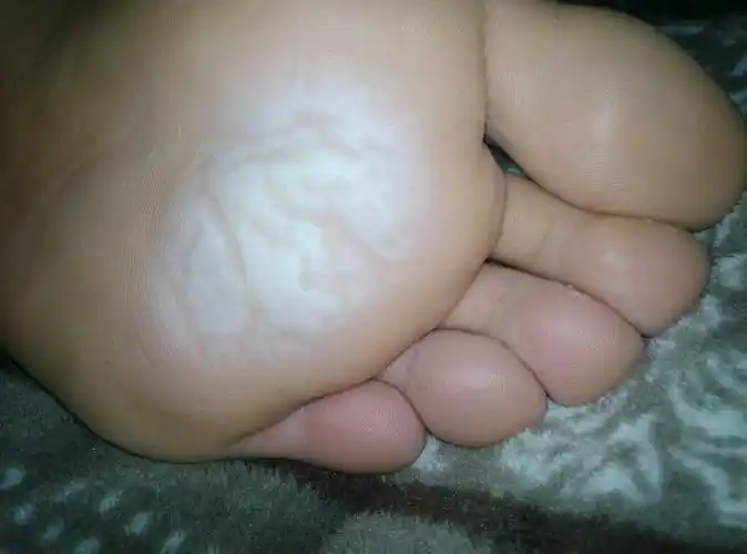 还是什么?有解决的方法吗