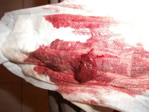 回怎个块经月事来有血么大