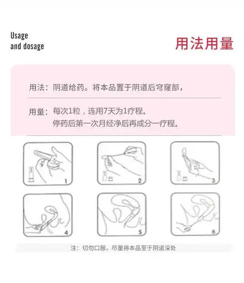 欧替 载体舒 双唑泰阴道膨胀栓2粒 细菌性阴道病念珠