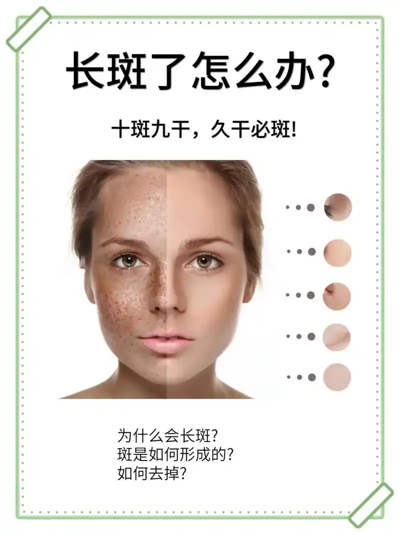 长斑必看!拒绝脸上长斑!有斑的姐妹看过来.十斑九干,久干必斑 - 抖音