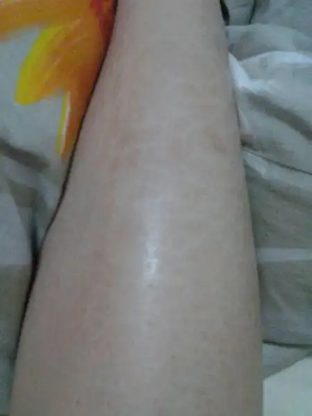 生活常识医疗皮肤科