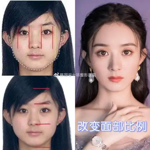 早期的赵丽颖,脸部脂肪明显较厚,圆脸的骨架,让整张脸看上去肉嘟嘟的