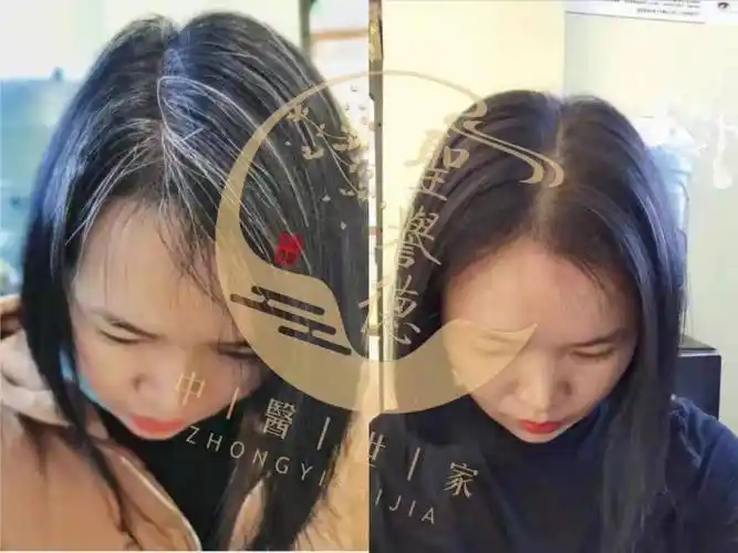 妙手治白发圣誉德祁医师的神奇之处