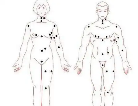 女生胸前长痣代表什么 长中间和外侧好不好