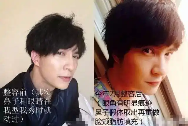 薛之谦有没有欺骗感情尚无定论但他肯定整容了