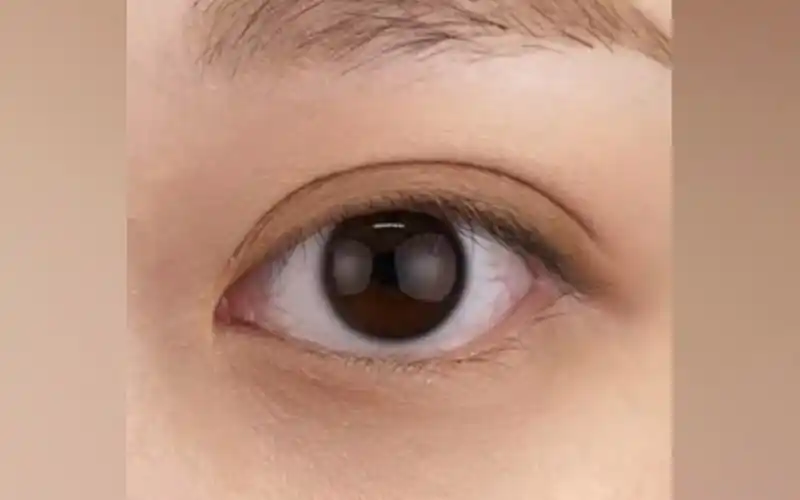 超自然的平行双眼皮,8mm正正好!