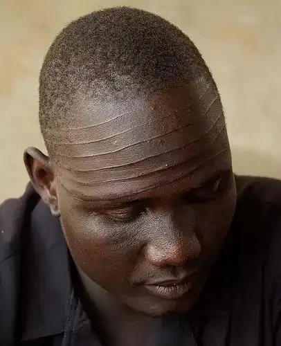 世界上最黑的孩子!一出生就成名的baby 全球唯一!