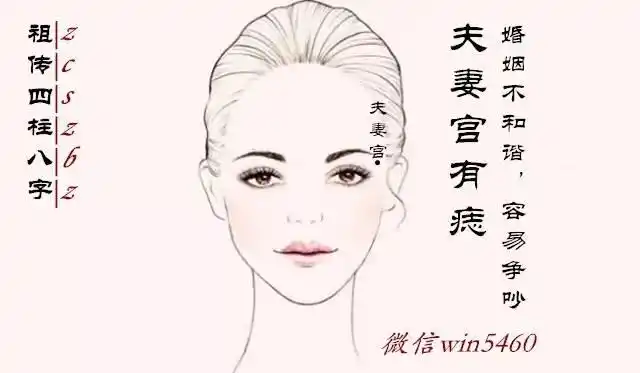 夫妻宫有痣:暗示婚姻不和谐,容易争吵不利.