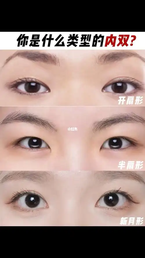 3种不同内双类型75快来看看你是哪一种_内双_时装周_肿眼泡_我的