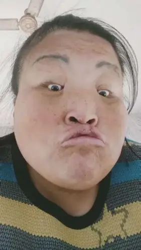 把美颜关上好丑啊太丑了脸上的黑点点都暴露了嘴上和鼻子上的小痘痘都