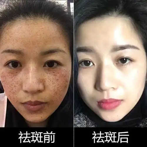 最新统计美白淡斑护肤品排行榜前十名这三款凭实力上榜