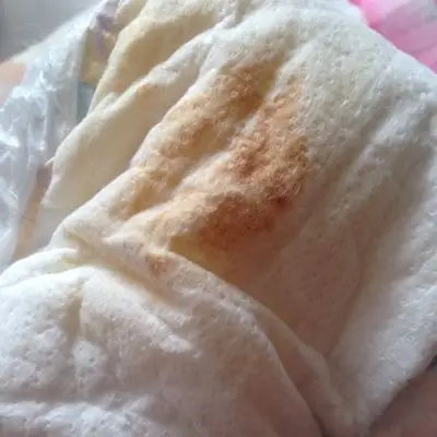 宝宝八个月了,吃了治拉肚子的药之后,尿出的尿怎麼有褐色的东西啊