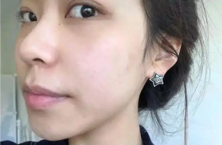 1周肌肤白3度是什么体验这款新娘婚前也用的急救单品让暗沉肌一夜回春