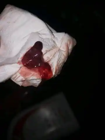 问答 准备怀孕 育儿问题这裏搜 取消 最佳回答          你是不是怀孕