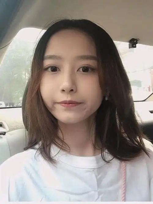 快要3个月时间了,然后上传几张素颜照片吧,是不是特_圈子-新氧美容