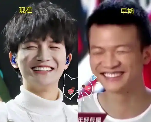 出道后,她去整容,并自称"纯天然",明星的脸已经出卖了它|杨幂|周深