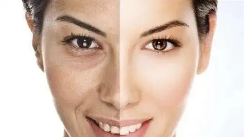 皮肤暗沉,发黄,肤色不均,该怎么办?