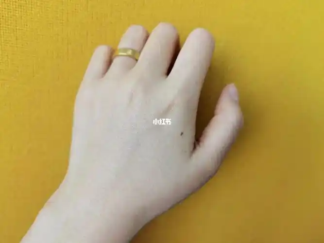 左手虎口,右手无名指#痣