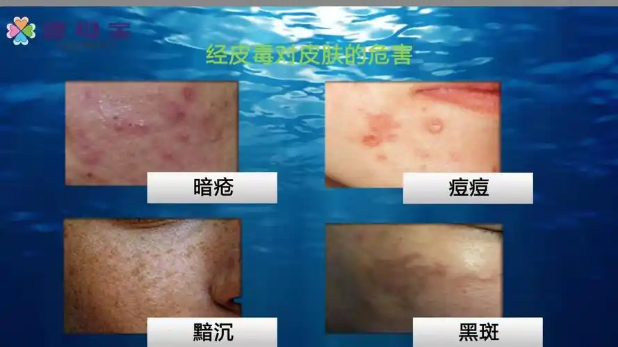 根据这个词的字面意思就是可以通过皮肤进入人体的一些毒素,也就是