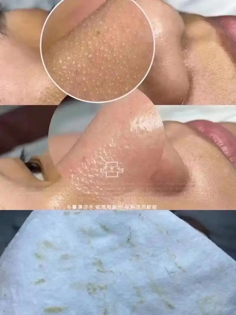 上热门话题6000亿流量 #黑头粉刺螨虫 #清洁皮肤 #不 - 抖音