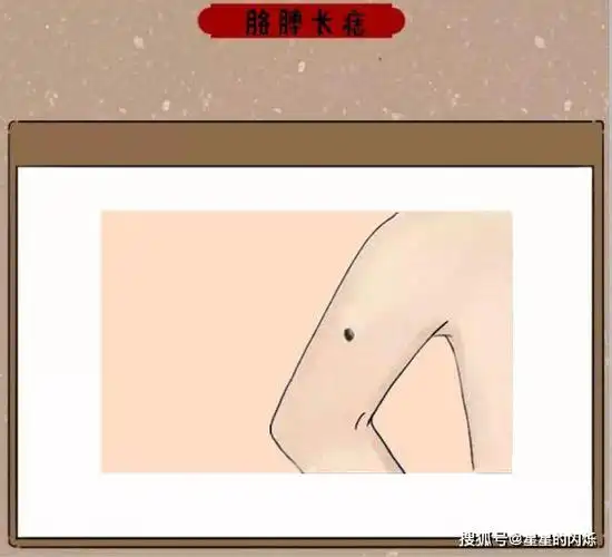 身体5大黄金吉痣,儿孙贤孝,事业兴,万里挑一的好命