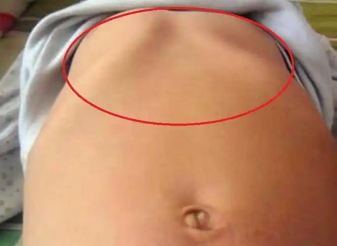 它的发病原因又是什么?