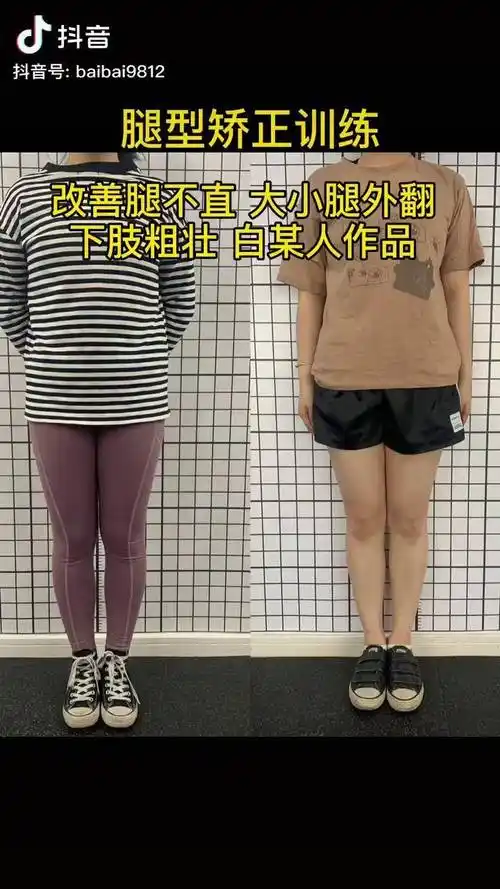 腿型非常重要腿不直自然会看着比较粗瘦小腿腿型矫正
