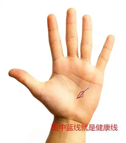 岛纹掌纹诊病岛纹是什么形状图片