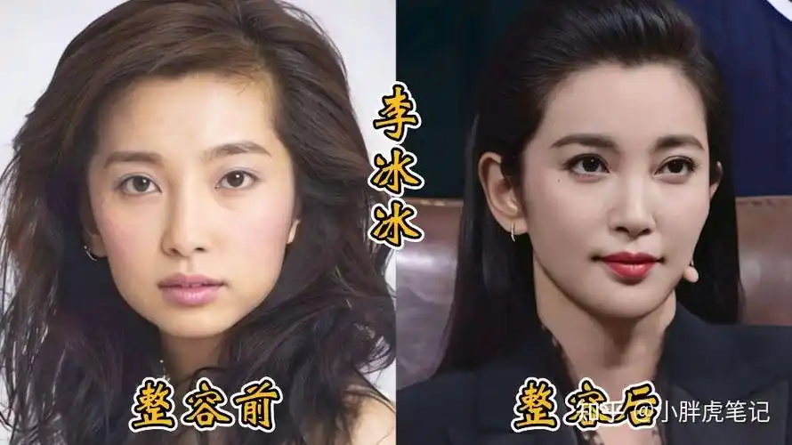 18位女明星整容前后对比邵音音面目全非杨颖堪称整容模板