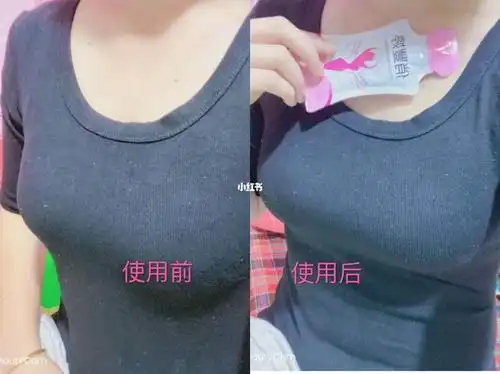 爱美需适度慎用丰胸品丰胸产品可以用吗