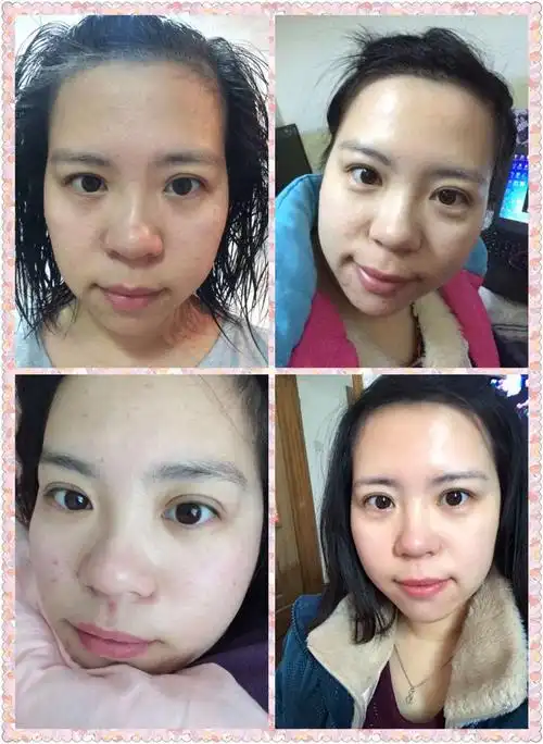 麦吉丽护肤品效果怎么样?使用过的回答(请附使用对比图)