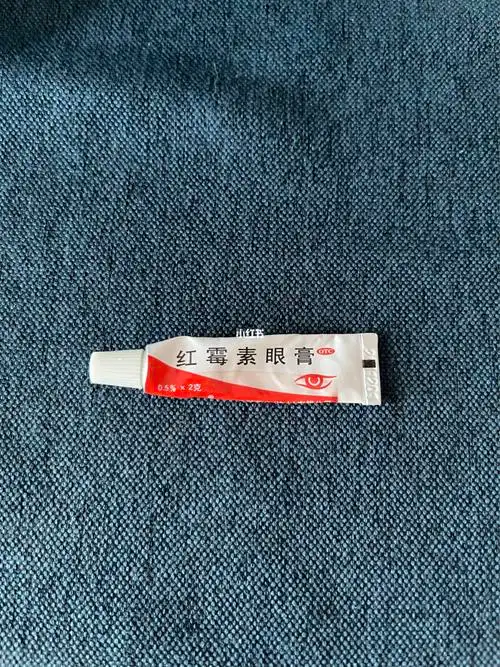 买了眼膏,误打误撞,后面看医生说红霉素眼膏效果更好91只涂这个药膏