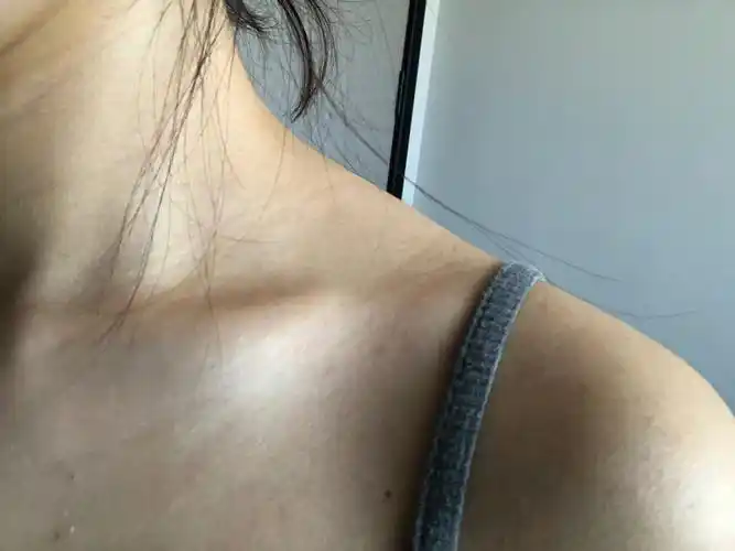 小红薯的集美们 可以帮我看看 我这突出的硬邦邦的是啥呀 #斜方肌